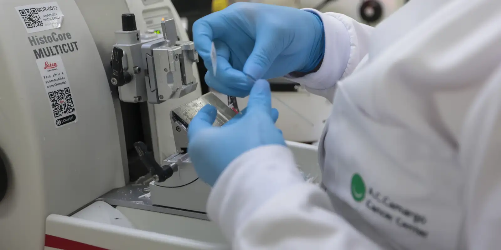 SUS incorpora tratamento inovador para leucemia mieloide aguda em pacientes adultos